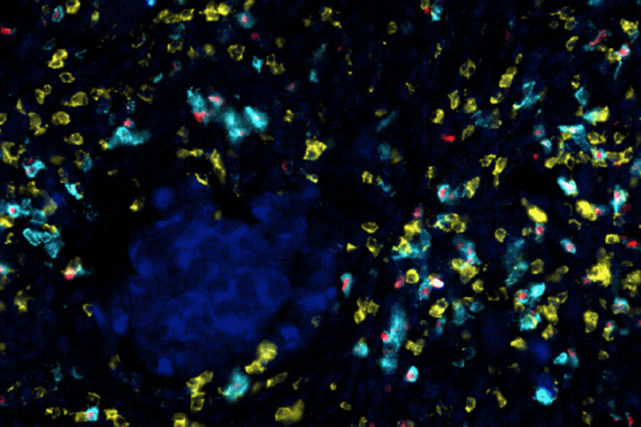 ‘Cutting the cable’ between CD8+ T and T regulatory cells enhances ...